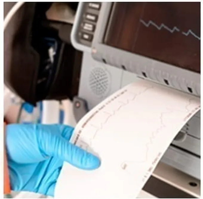 Reviewing an ECG printout