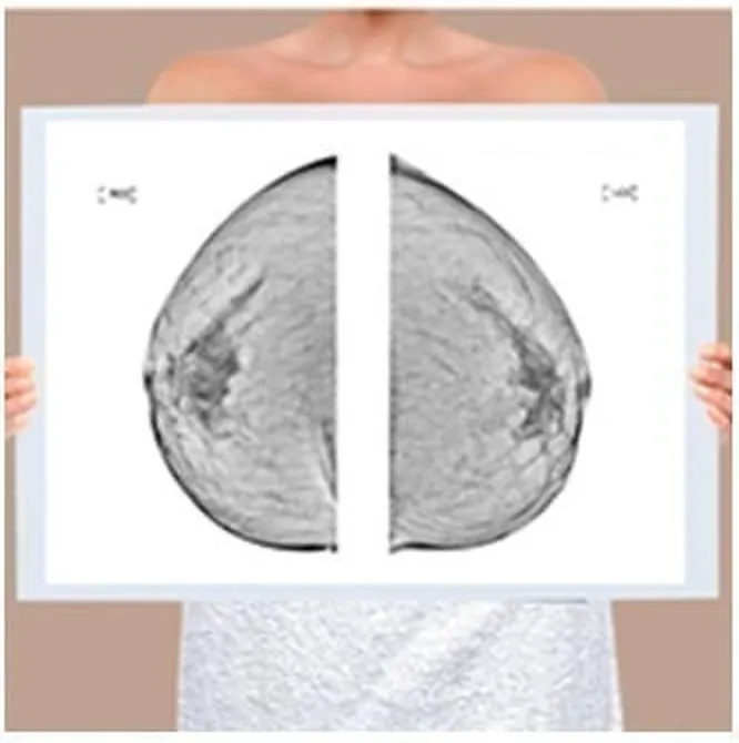 Mammogram reading films