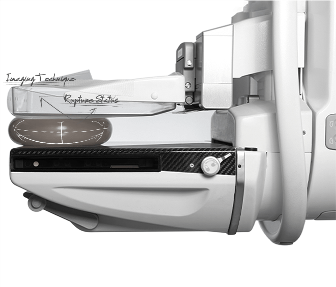 Mammography img172