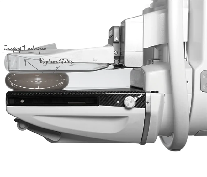 Mammography img172