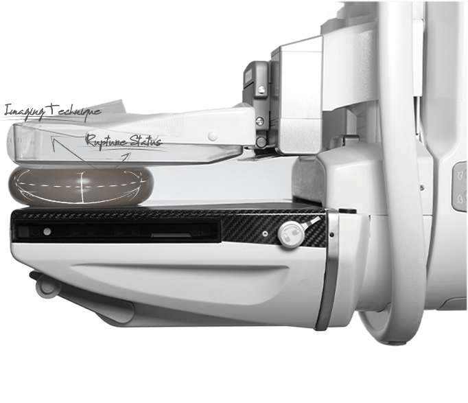 Healthy Breast Mammography img1 m