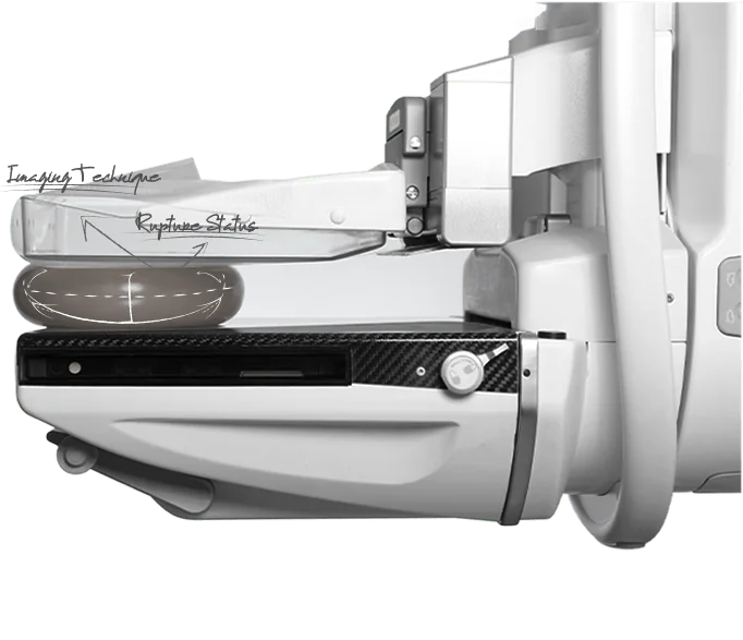 Healthy Breast Mammography img1 m