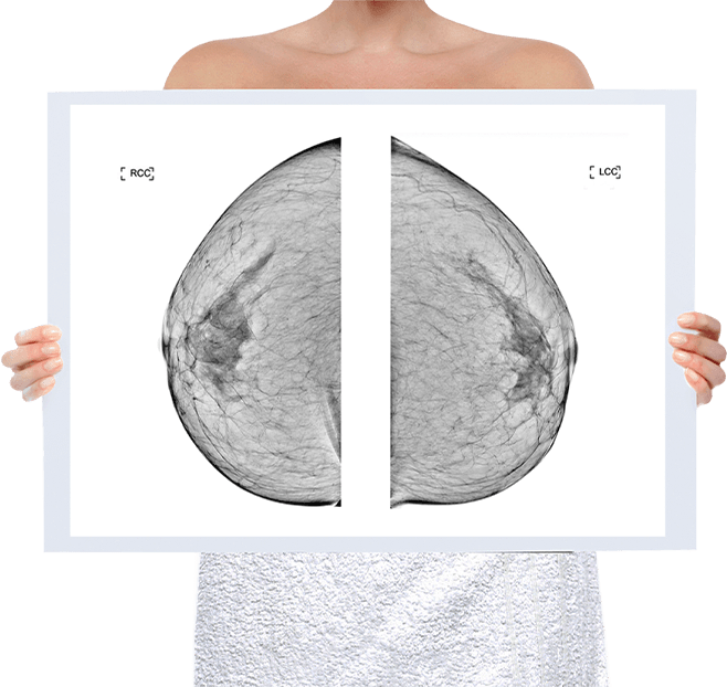 Healthy Breast Mammography img5 m