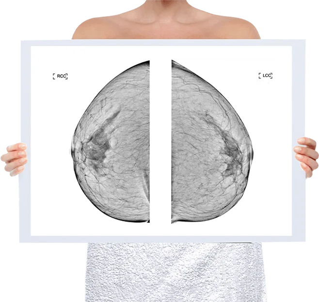 Healthy Breast Mammography img5 m
