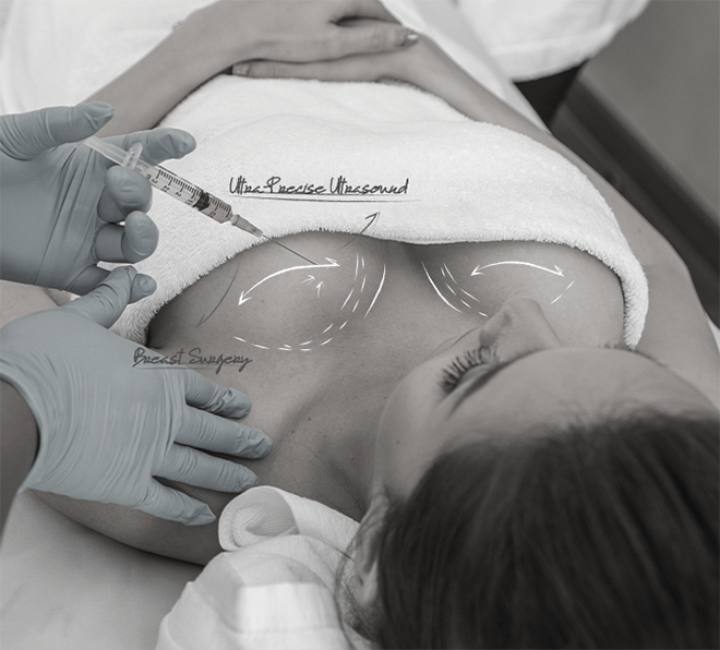 Healthy Breast Mammotome img1 1