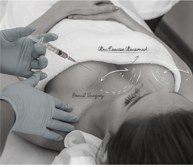 Healthy Breast Mammotome img1 m 1