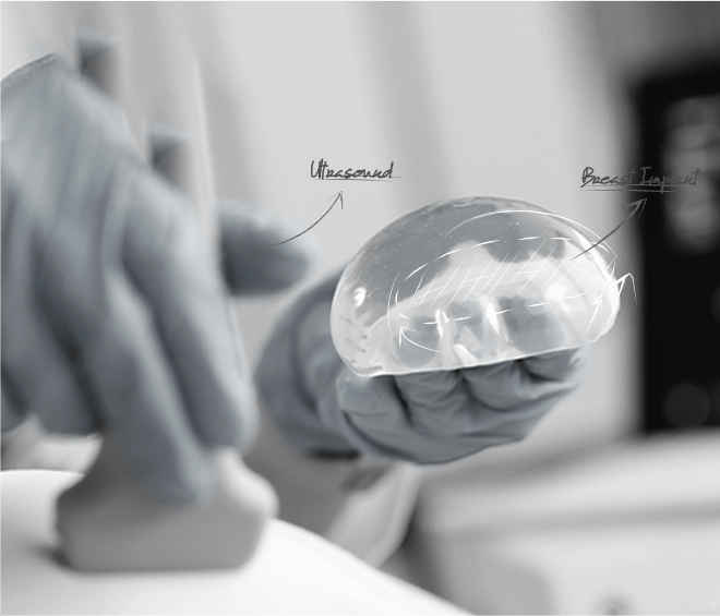 Healthy Breast Implant Ultrasound img1 m