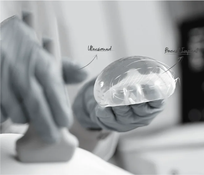 Healthy Breast Implant Ultrasound img1 m