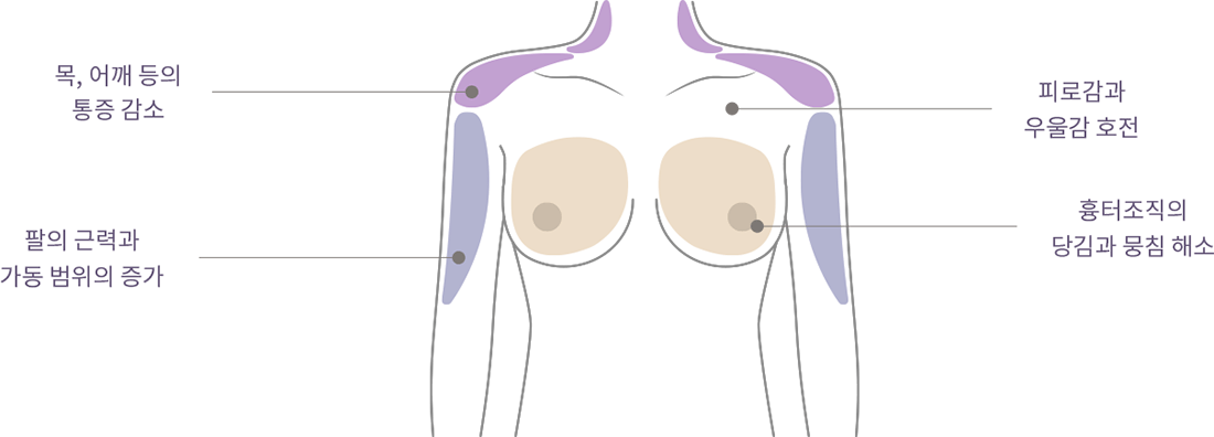 happy breast Pilates img3
