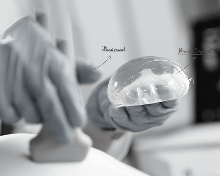 healthy breast implant ultrasound img12