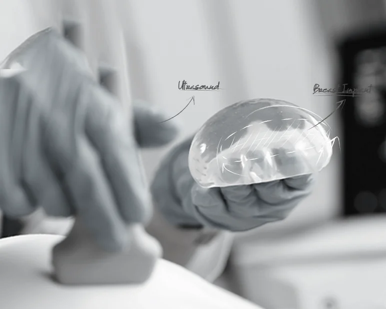 healthy breast implant ultrasound img12